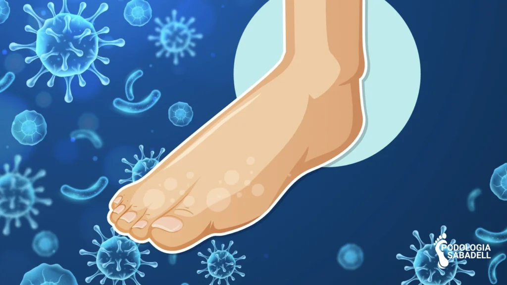 Fongs als peus (Dermatomicosi Plantar): Causes, Prevenció i Tractament